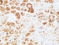 UCH-L1 Polyclonal Antibody