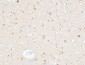 UCH-L1 Polyclonal Antibody