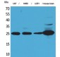 UCH-L1 Polyclonal Antibody