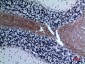 Eotaxin-3 Polyclonal Antibody