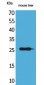 TNF-α Polyclonal Antibody