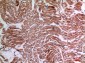 TNF-α Polyclonal Antibody