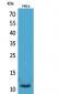 IL-8 Polyclonal Antibody