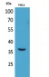 Mcl-1 Polyclonal Antibody