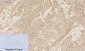 Mcl-1 Polyclonal Antibody