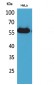 Amylase Polyclonal Antibody