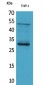 FGF-23 Polyclonal Antibody