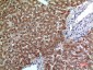 CD66e Polyclonal Antibody