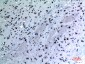 Cytokeratin 14 Polyclonal Antibody