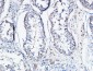 Angptl4 Polyclonal Antibody