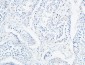 Angptl4 Polyclonal Antibody