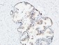 MK Polyclonal Antibody