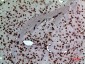 MK Polyclonal Antibody