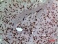 MK Polyclonal Antibody