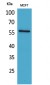 ALK-1 Polyclonal Antibody