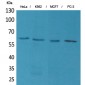 p63 Polyclonal Antibody