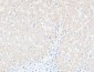 CRP Polyclonal Antibody
