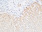 CRP Polyclonal Antibody