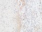 IL-1β Polyclonal Antibody