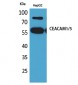 CEACAM1/5 Polyclonal Antibody
