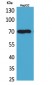 Glypican-3 Polyclonal Antibody