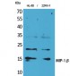 MIP-1β Polyclonal Antibody