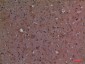 Calbindin D28K Polyclonal Antibody
