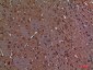 Calbindin D28K Polyclonal Antibody