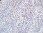 FOXP1 Polyclonal Antibody