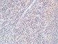 FOXP1 Polyclonal Antibody