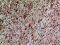 Keap1 Polyclonal Antibody