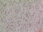 Lipocalin-1 Polyclonal Antibody