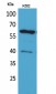 CYP11A1 Polyclonal Antibody