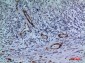 CYP11A1 Polyclonal Antibody