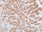 HDC Polyclonal Antibody