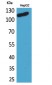 DPYD Polyclonal Antibody