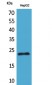 SNAP 23 Polyclonal Antibody