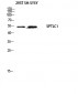 SPTLC1 Polyclonal Antibody