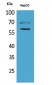 HEXA Polyclonal Antibody
