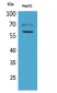 HEXA Polyclonal Antibody