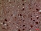 HEXA Polyclonal Antibody