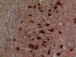 HEXA Polyclonal Antibody