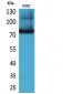 Transferrin Polyclonal Antibody