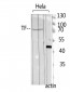 Transferrin Polyclonal Antibody