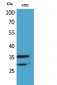 IL-2Rα Polyclonal Antibody