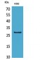 CD58 Polyclonal Antibody