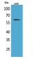 IL-2Rβ Polyclonal Antibody