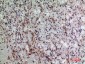PDGFR-α Polyclonal Antibody