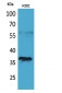 CD207 Polyclonal Antibody