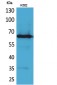 Frizzled-10 Polyclonal Antibody